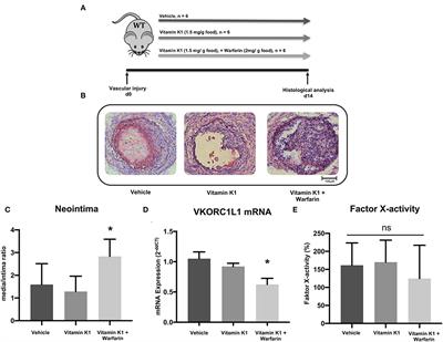 Vitamin K Epoxide Reductase Complex Subunit 1-Like 1 (VKORC1L1) Inhibition Induces a Proliferative and Pro-inflammatory Vascular Smooth Muscle Cell Phenotype